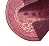 Cholesterol Poster Print by Spencer Sutton/Science Source - Item # VARSCIBW1483