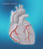 Coronary Arteries, Illustration Poster Print by Monica Schroeder/Science Source - Item # VARSCIJB5230