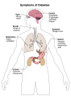 Symptoms of Diabetes Poster Print by Spencer Sutton/Science Source - Item # VARSCIBY8024