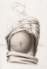 Cesarean Section, Incisions, Illustration, 1822 Poster Print by Science Source - Item # VARSCIJA1794