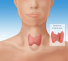 Thyroid & Parathyroid Poster Print by Monica Schroeder/Science Source - Item # VARSCIJC2655