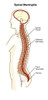 Spinal Meningitis Poster Print by Spencer Sutton/Science Source - Item # VARSCIBZ4334