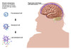 Chronic Senescence and Brain Shrinkage Poster Print by Gwen Shockey/Science Source - Item # VARSCIJC6239