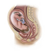 Full-term baby in uterus. Poster Print by TriFocal Communications/Stocktrek Images - Item # VARPSTTRF700086H
