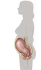 Profile of woman showing pregnant uterus and pelvic organs. Poster Print by TriFocal Communications/Stocktrek Images - Item # VARPSTTRF700070H