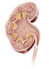 Cross section of a human kidney. Poster Print by Alan Gesek/Stocktrek Images - Item # VARPSTAGK700042H