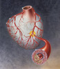 Arteries on heart showing atherosclerotic plaque in an artery. Poster Print by TriFocal Communications/Stocktrek Images - Item # VARPSTTRF700040H