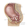 Sagittal view of pregnant uterus showing displaced pelvic organs. Poster Print by TriFocal Communications/Stocktrek Images - Item # VARPSTTRF700102H