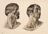 Muscles and Blood Vessels in Neck, 1851 Poster Print by Science Source - Item # VARSCIJB5457