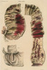 Cholera Infected Intestines, 1808 Poster Print by Science Source - Item # VARSCIBW7100