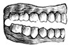 Dentures, C1900./Nline Cut. Poster Print by Granger Collection - Item # VARGRC0031825