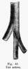 Human Artery. /Nline Engraving, French,19Th Century. Poster Print by Granger Collection - Item # VARGRC0077008