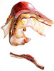 Two Sections of Aortic Aneurysm Poster Print by Science Source - Item # VARSCIJB5966