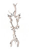 Arteries at Brain Base, Rare Variation Poster Print by Science Source - Item # VARSCIJB5969