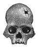 Trepanning. /Na Trephined Skull Of Ancient Peru. Wood Engraving, Late 19Th Century. Poster Print by Granger Collection - Item # VARGRC0068157