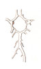 Arteries at Brain Base, Circle of Willis Poster Print by Science Source - Item # VARSCIJB5970