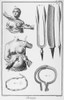 Breast Surgery. /Ncopper Engravings, French, 18Th Century, From Denis Diderot'S 'Encyclopedia.' Poster Print by Granger Collection - Item # VARGRC0104742