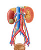 Early stage of kidney cancer with a tumor visible on the kidney Poster Print by Stocktrek Images - Item # VARPSTSTK701043H