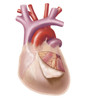 Heart with pericadium pulled back exposing heart muscle Poster Print by TriFocal Communications/Stocktrek Images - Item # VARPSTTRF700059H