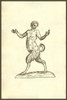 Infans partibus inferioribus caninis, child with a dog's lower body.   From the 1642 book Monstrorum Historia by Ulisse Aldrovandi .   He is considered the founder of modern Natural History. Poster Print by Ulisse Aldrovandi - Item # VARBLL0587418281