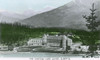 Canada - Chateau Lake Louise  Alberta Poster Print By Mary Evans / Grenville Collins Postcard Collection - Item # VARMEL10411917