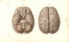 Brain From Above And Below Poster Print By ® Florilegius / Mary Evans - Item # VARMEL10939644