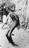 Deformed Mexican Boy History - Item # VAREVCHCDLCGBEC089