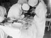 Attending Surgeon Leans Over To Work Closely Over A Patient'S Abdomen. The Surgical Field Is Stained With Blood. 1922 In A Hospital In Washington History - Item # VAREVCHISL043EC214