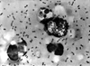 Yersinia Pestis Bacteria Which Caused Bubonic Plague. 1965. History - Item # VAREVCHISL016EC038