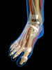 X-ray view of a woman's foot. Poster Print by Hank Grebe/Stocktrek Images - Item # VARPSTHAG700014H