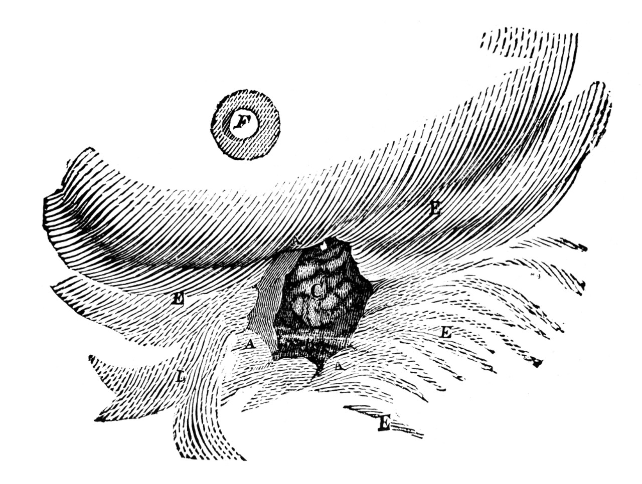 St. Martin S Fistula. Nillustration By William Beaumont Showing The Hole In Alexis St. Martin S Gastrointesinal System. 1833. Poster Print by Granger