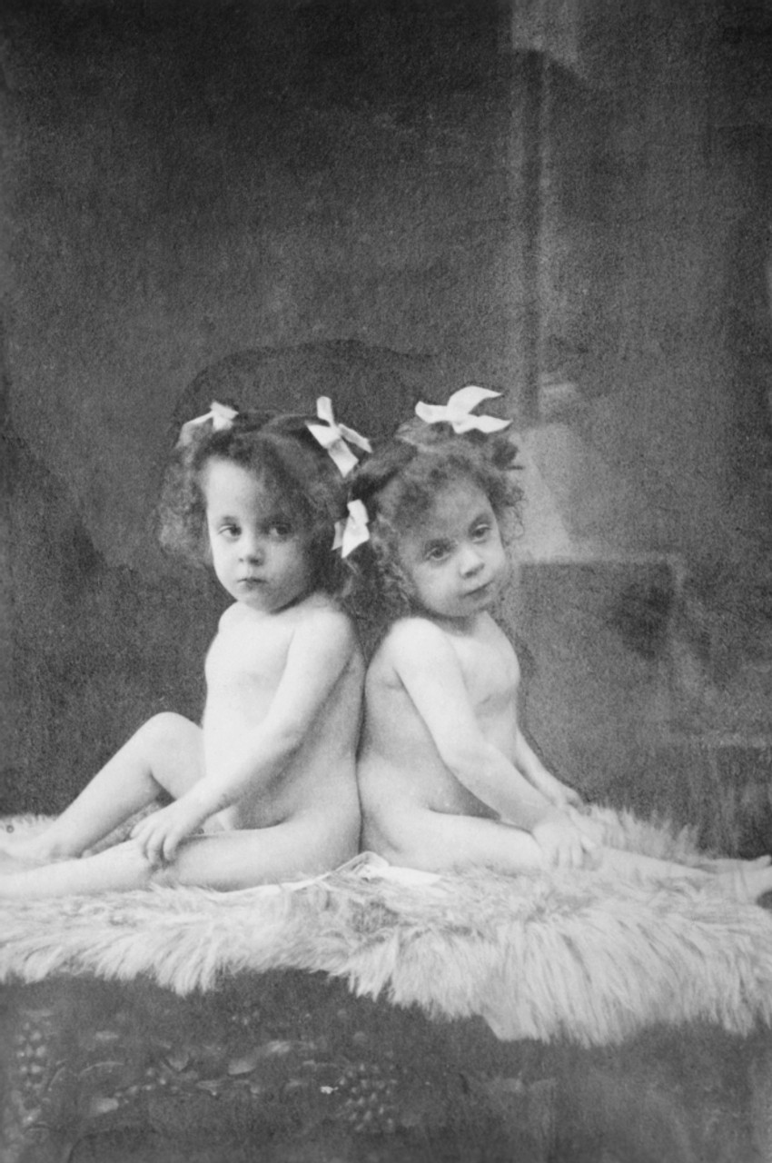 violet and daisy hilton