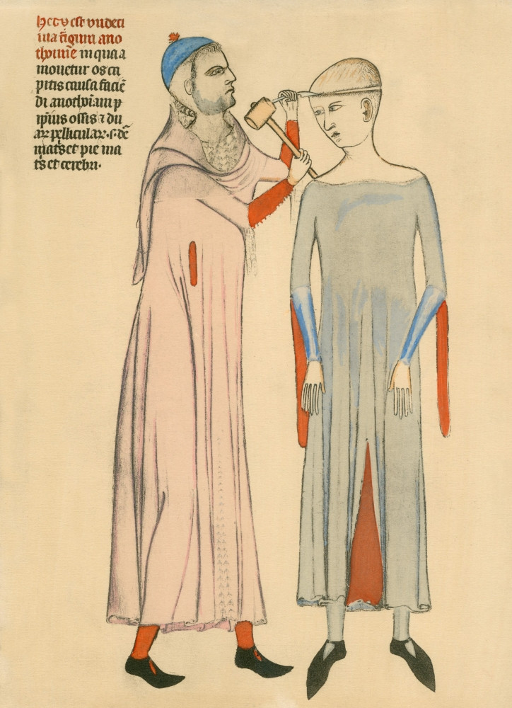 medieval medical drawings