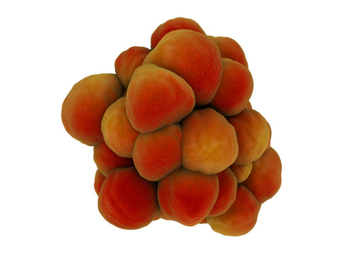 Microscopic view of tumor Poster Print - Item # VARPSTSTK700894H