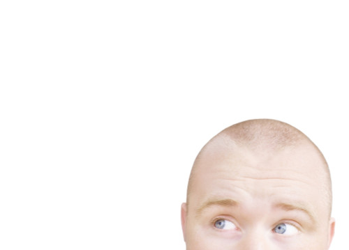 Part Of A Man's Head Looking Sideways PosterPrint - Item # VARDPI1820378