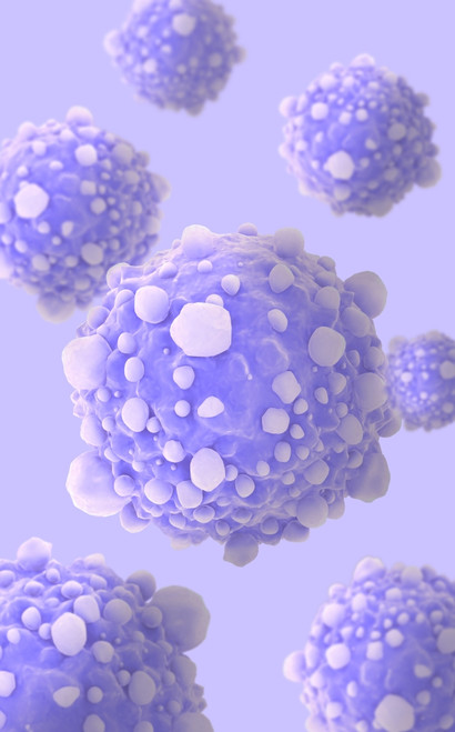 Microscipic view of pancreatic cancer cells Poster Print - Item # VARPSTSTK700885H