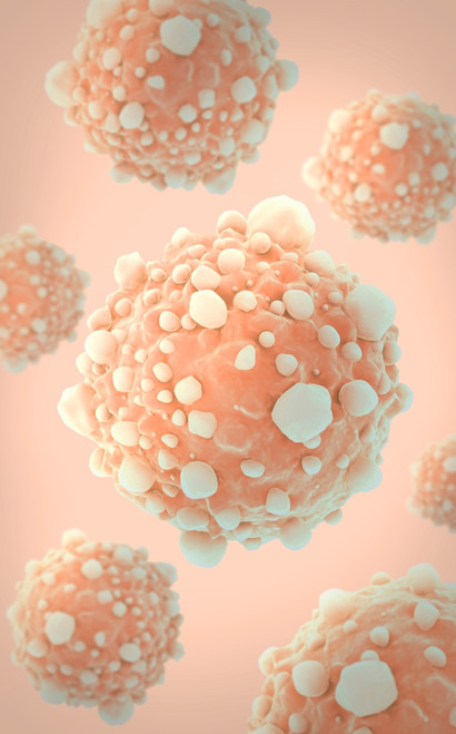 Microscipic view of pancreatic cancer cells Poster Print - Item # VARPSTSTK700886H