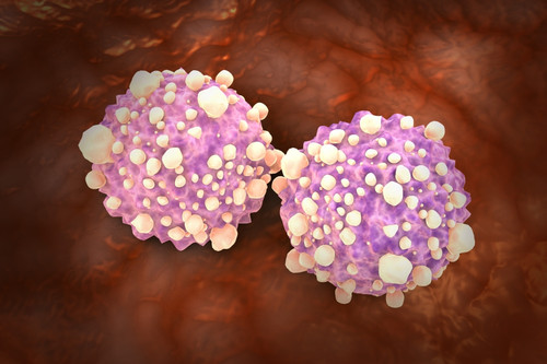 Microscipic view of pancreatic cancer cells Poster Print - Item # VARPSTSTK700891H