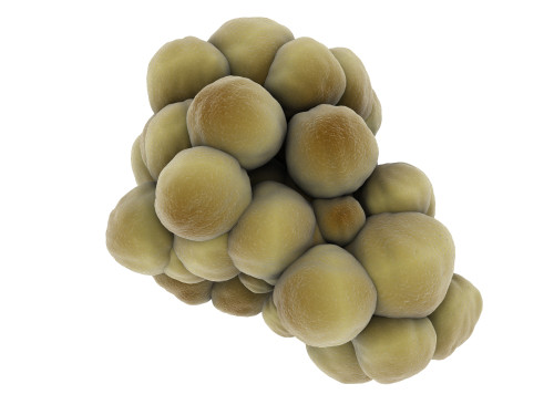 Microscopic view of tumor Poster Print - Item # VARPSTSTK700897H