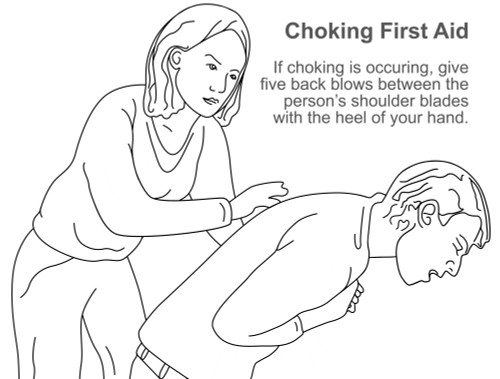 Choking First Aid Poster Print by Gwen Shockey/Science Source - Item # VARSCIBY1898