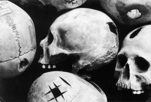 Skulls Showing Trepanation Poster Print by Science Source - Item # VARSCIBN9568