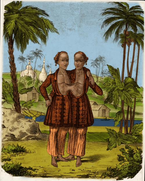 Chang and Eng, Siamese Twins Poster Print by Science Source - Item # VARSCIJC9506