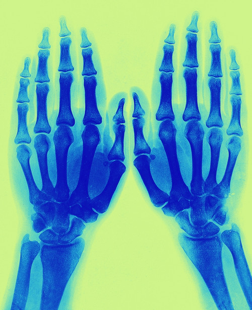 X-Ray of Two Normal Hands, 1896 Poster Print by Science Source