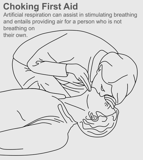 Choking First Aid Poster Print by Gwen Shockey/Science Source - Item # VARSCIBY1962