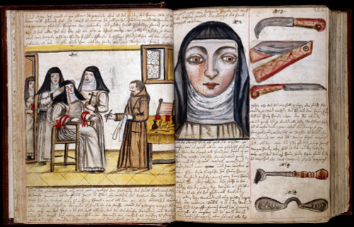 Ophthalmic Surgery for Lachrimal Fistula, 1675 Poster Print by Science Source - Item # VARSCIJA0910