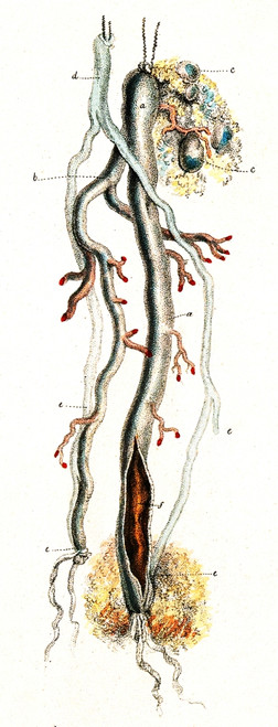 Amputated Nerve and Artery, Illustration Poster Print by Science Source - Item # VARSCIJB6891