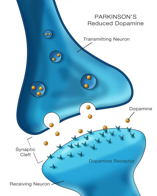 Dopamine & Parkinson's Disease Poster Print by Monica Schroeder/Science Source - Item # VARSCIJC2597
