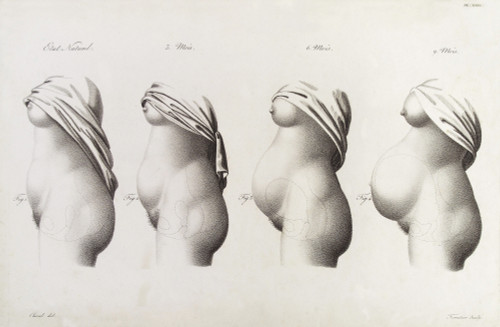 Pregnancy, Trimesters, Illustration, 1822 Poster Print by Science Source - Item # VARSCIJA1793