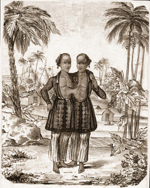 Chang and Eng, Siamese Twins Poster Print by Science Source - Item # VARSCIJA0938