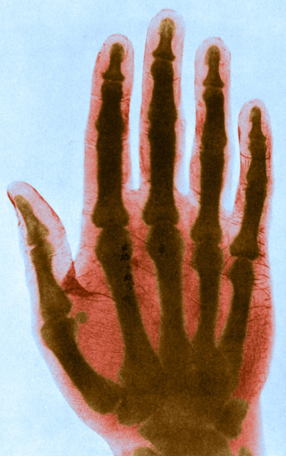 Early X-ray Poster Print by Science Source - Item # VARSCIBS4860